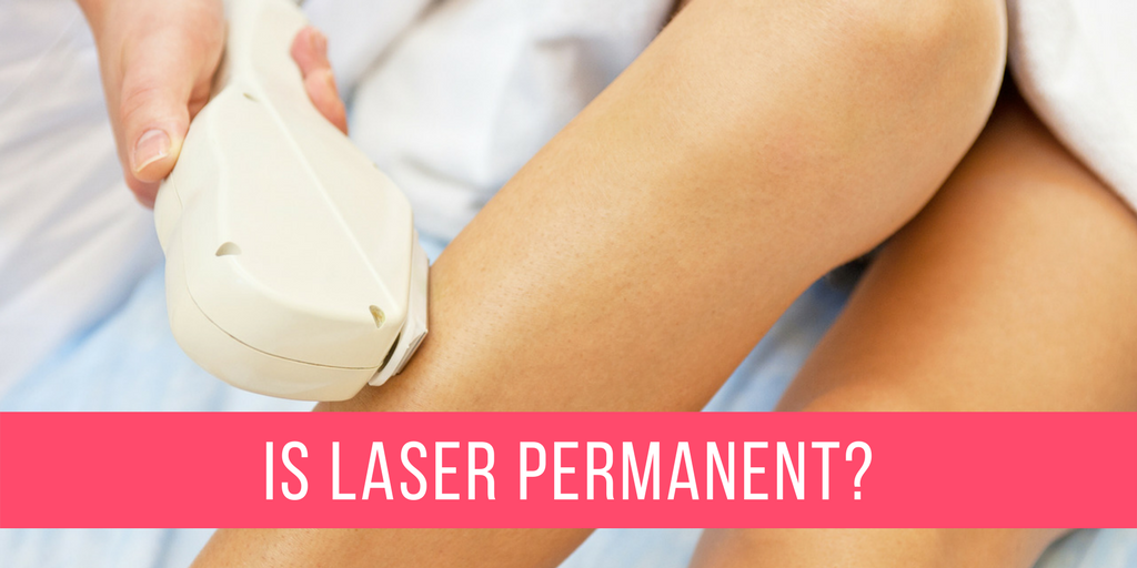 Is Laser Hair Removal Permanent
